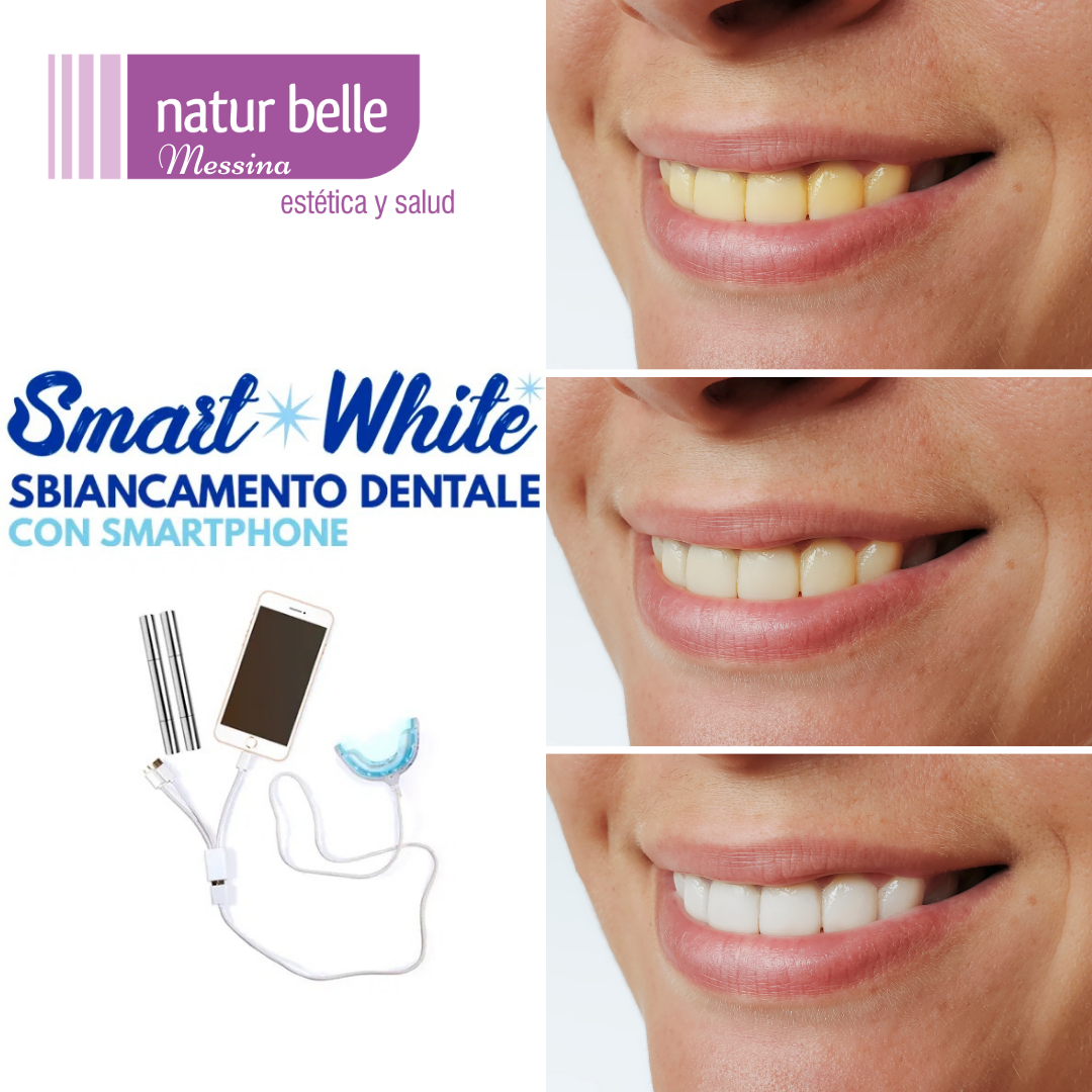 Kit Smart White